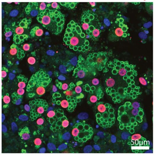 Νέα έρευνα για τη χρησιμότητα των καφέ λιποκυττάρων στην αντιμετώπιση χρόνιων ασθενειών