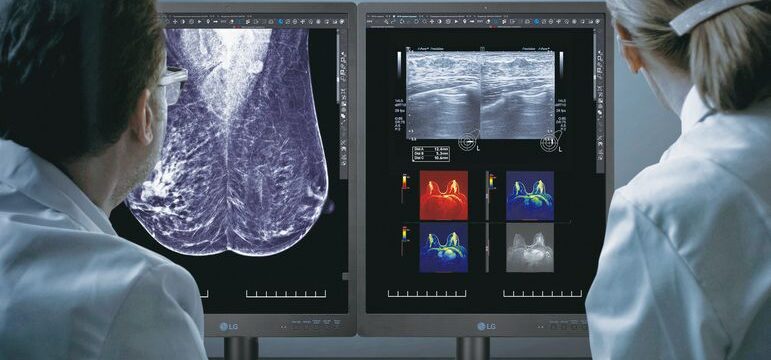[Image] LG Diagnostic Monitor (21HQ613D) (1)