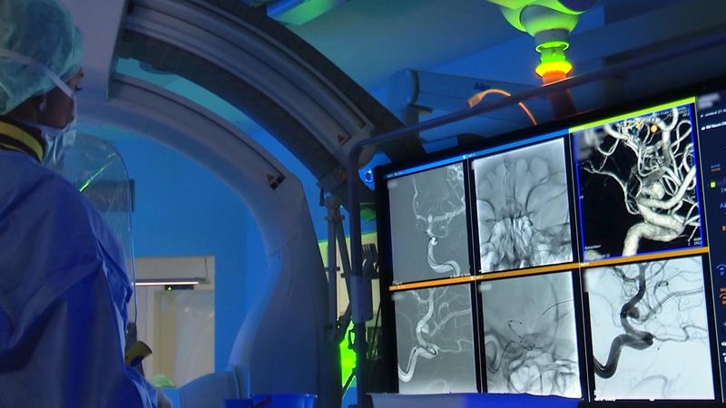 Συνεργασία της SIEMENS HEALTHINEERS και του Παγκόσμιου Οργανισμού Υγείας για τα αγγειακά επεισόδια