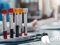 Pre-Analytical Phase Affidea