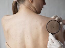 female-doctor-diagnosing-melanoma-body-female-patient (1)