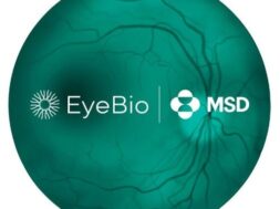 MSD_EyeBio