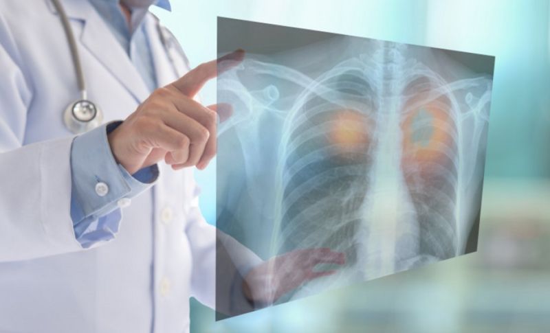 Προκήρυξη μίας υποτροφίας κλινικού έργου για το 2024 από την Ελληνική Πνευμονολογική Εταιρεία