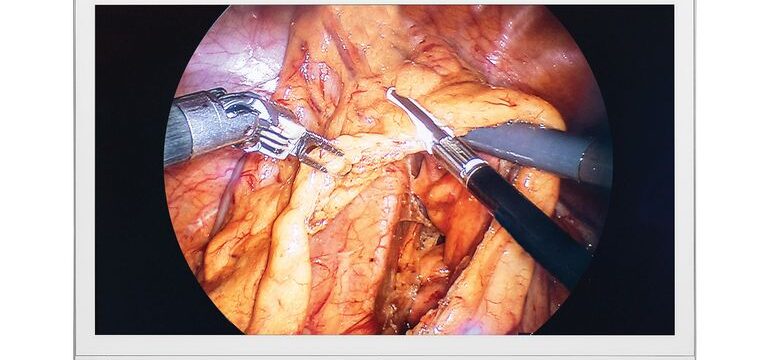 32HR734S_1_front_logo_X