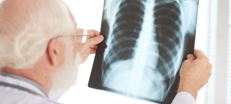 Checking x-ray