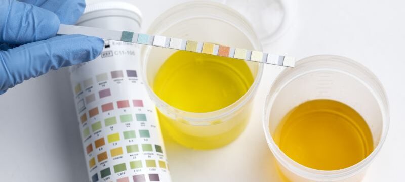 lab-doctor-performing-medical-exam-urine