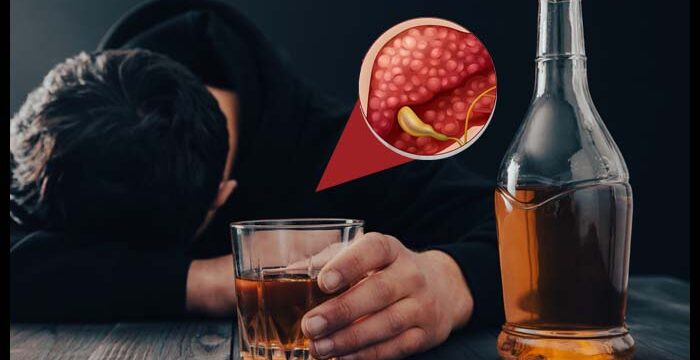 alcohol-27052025-lt