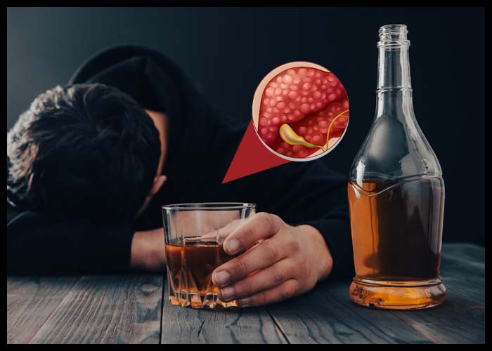 Η κατανάλωση αλκοόλ αυξάνει τον κίνδυνο καρκίνου του παγκρέατος, σύμφωνα με μελέτη