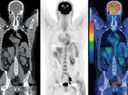 thumb__800_0_0_0_auto (1)