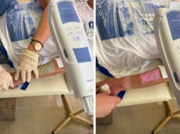 viruscomgr_kentro_ygeias_filiatrwn_exopllismos_collage-e1752592045902-center-top-1000×600