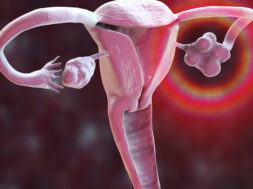 Polycystic_Ovary_Syndrome_Promo_PE_1796x943