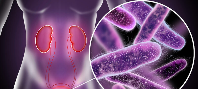 Illustration Of Woman Suffering From Cystitis. Urinary Infection