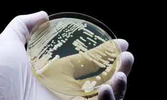 Candida auris: Σιωπηλή κρίση «υπερμύκητα» στην Ελλάδα;