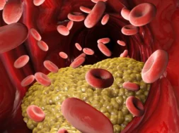 Triglycerides-1024×576.jpeg