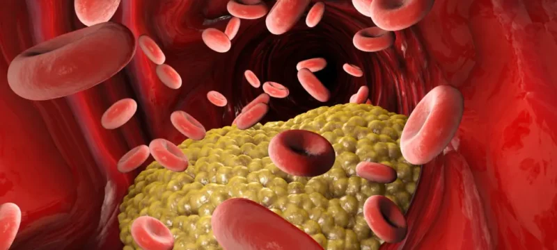 Triglycerides-1024×576.jpeg