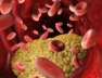 Triglycerides-1024×576.jpeg