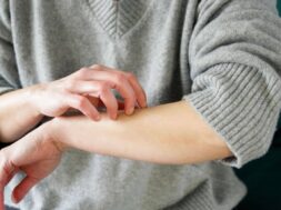 Woman scratching her arm (1)