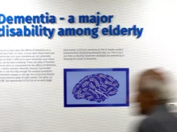 alzheimer