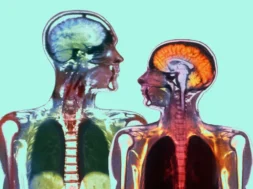 2a0fd5ba2f3699bb37047d39f0fdda7ff8-male-female-brain-aging.rhorizontal.w700