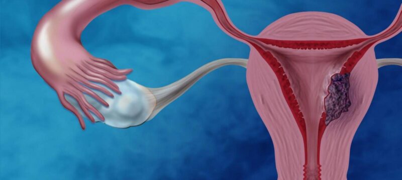 7be335477876db854960134c6e137164_XL