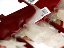 201208172037_aimodosia_2622019