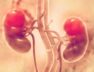 KidneyCancer_share