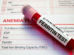 adobestock_494689138