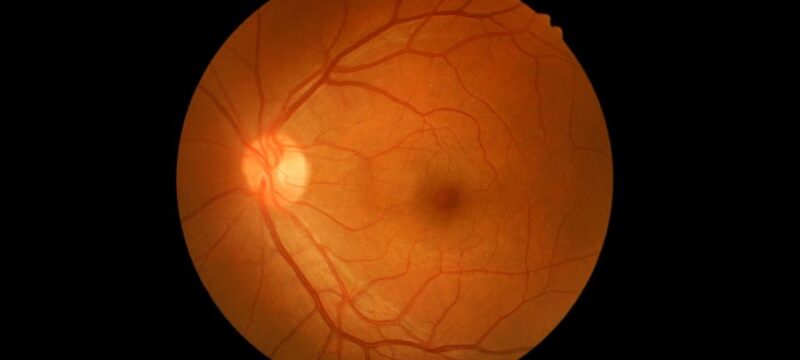 xr:d:DAEdmADxBCs:939,j:4113311105035329945,t:23080508