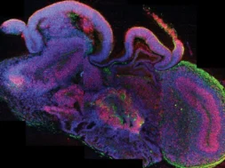 200309085129_CNA_Te5ace197448d477dbb9b951f085e7996