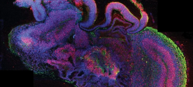 200309085129_CNA_Te5ace197448d477dbb9b951f085e7996