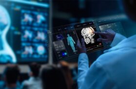 A group of medical professionals reviewing and analyzing detailed brain scans displayed on digital screens and tablets, highlighting advanced AI medical imaging technology.