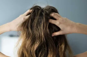 Itchy-Scalp-1322057120-967×544-ad_jpg