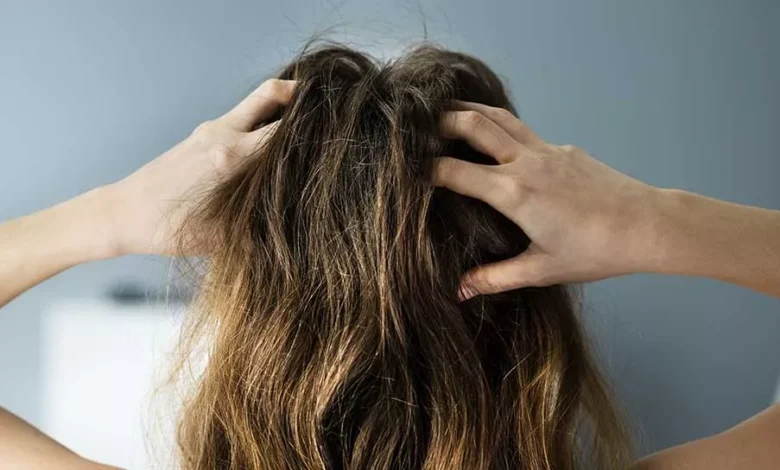 Itchy-Scalp-1322057120-967×544-ad_jpg