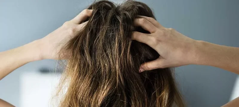 Itchy-Scalp-1322057120-967×544-ad_jpg