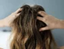 Itchy-Scalp-1322057120-967×544-ad_jpg