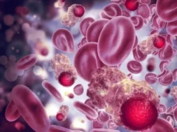 monoclonal gammopathy of undetermined significance (MGUS) and its importance to monitor it – virginia oncology associates