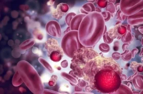 monoclonal gammopathy of undetermined significance (MGUS) and its importance to monitor it – virginia oncology associates