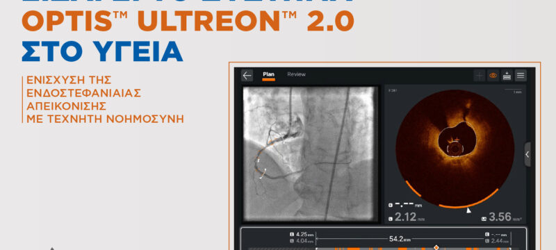 OPTIS ULTREON 2.0