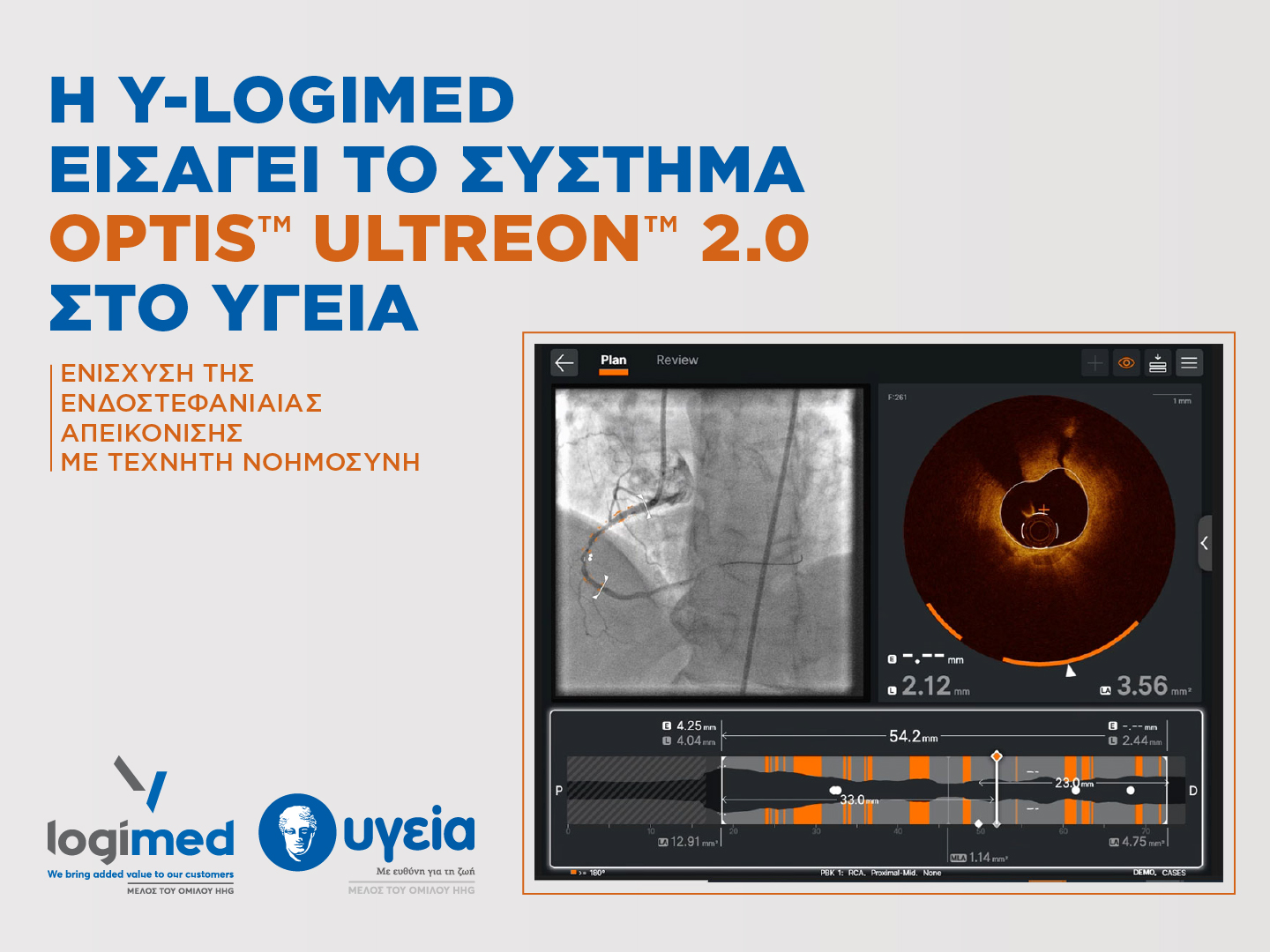 Νέα εποχή στην καρδιολογία με το σύστημα OPTIS™ ULTREON™ 2.0 από τη Y-Logimed