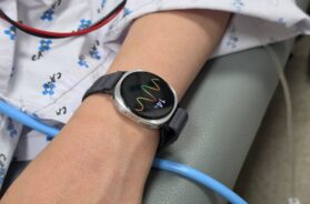galaxy_watch_fainting_prediction_image