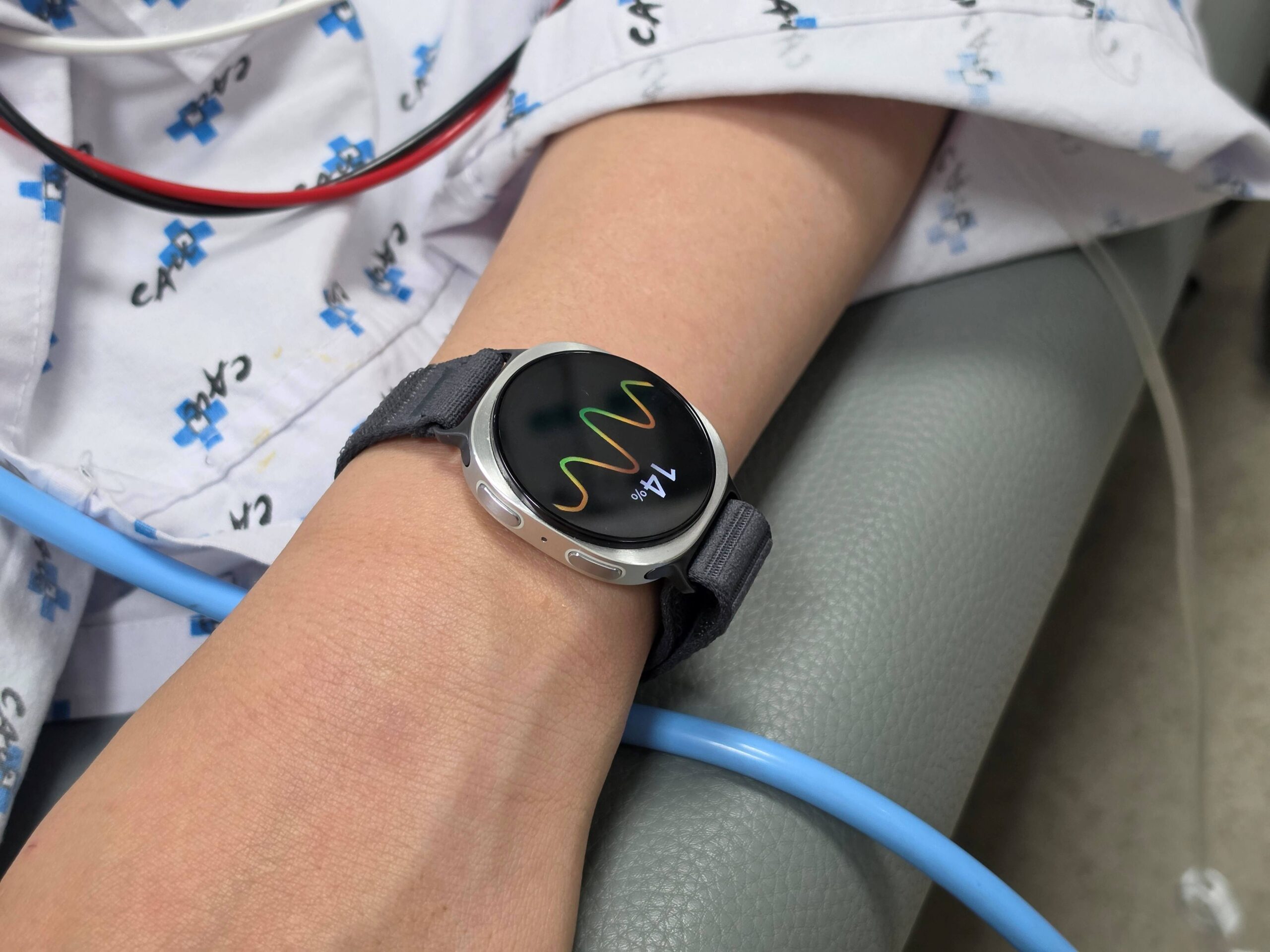 Το smartwatch της Samsung που μπορεί να «προειδοποιεί» για λιποθυμικά επεισόδια
