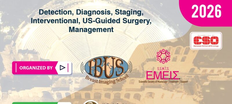 ΑΦΙΣΑ_IBUS